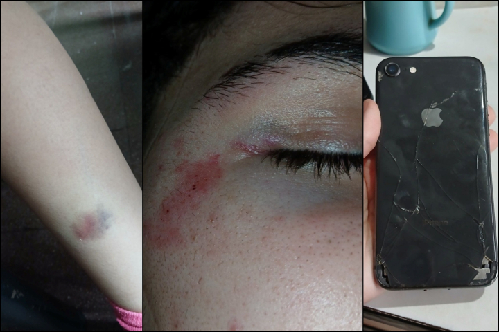 "Nos robó, nos golpeó y nos tiró piedras": una denuncia sacudió al barrio Aramburu