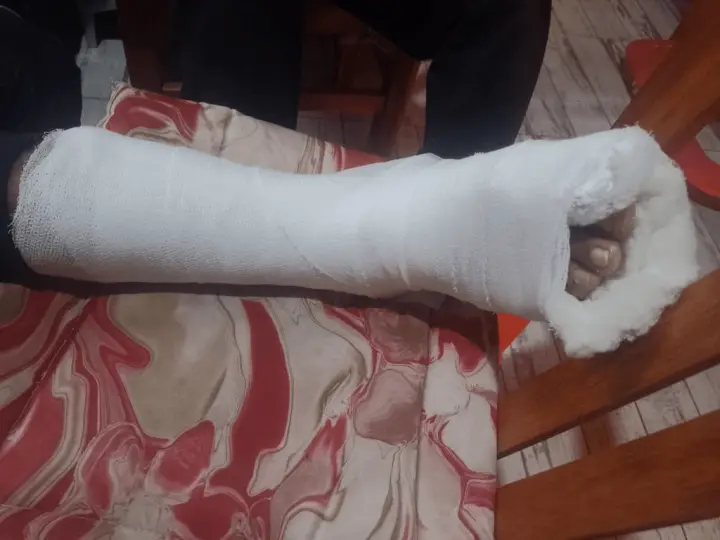 Una madre acusó a policías de golpear a su hijo y dejarlo con tres fracturas en San Juan