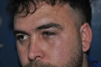 Dalmiro Arnau habló tras la agresión y mostró cómo quedó su rostro