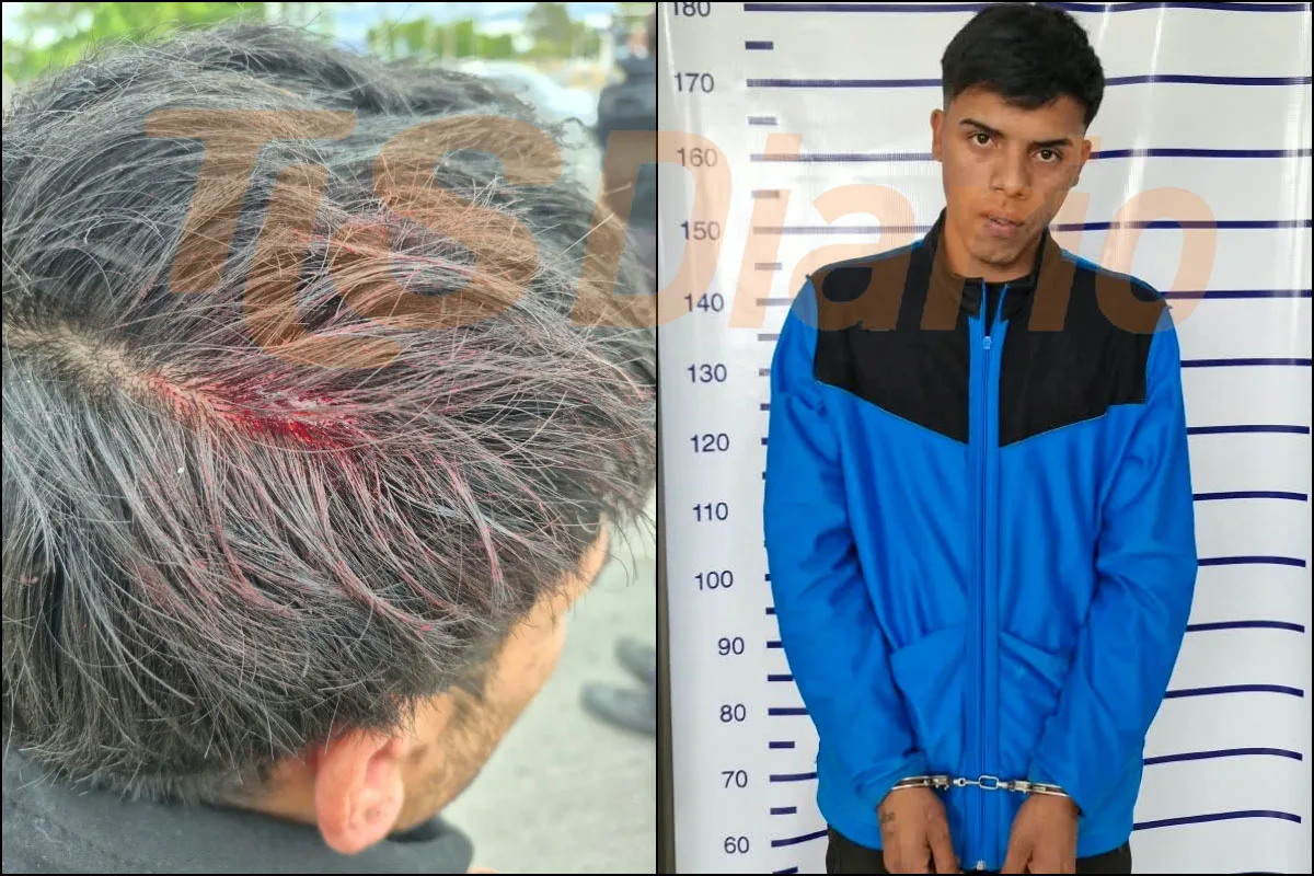Lo atacó con un fierro en la cabeza, escapó al Barrio La Estación y los vecinos apedrearon a la Policía para defender al agresor