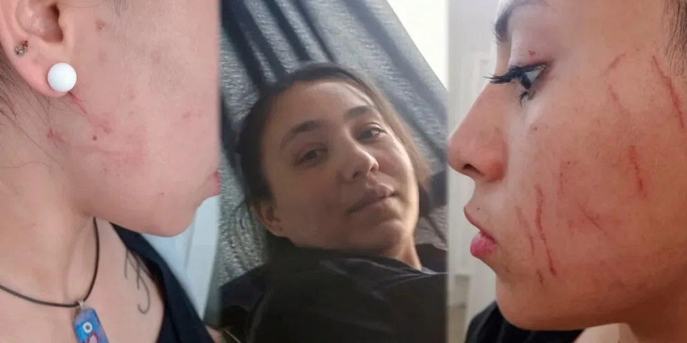Denunciaron a una mujer por amenazar a docentes y agredir a una pasajera