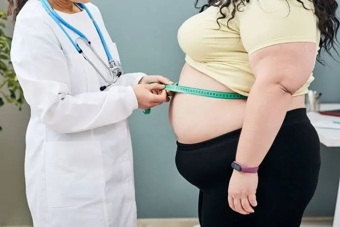 “La persona con obesidad no es floja”: un médico explicó por qué necesita un tratamiento integral